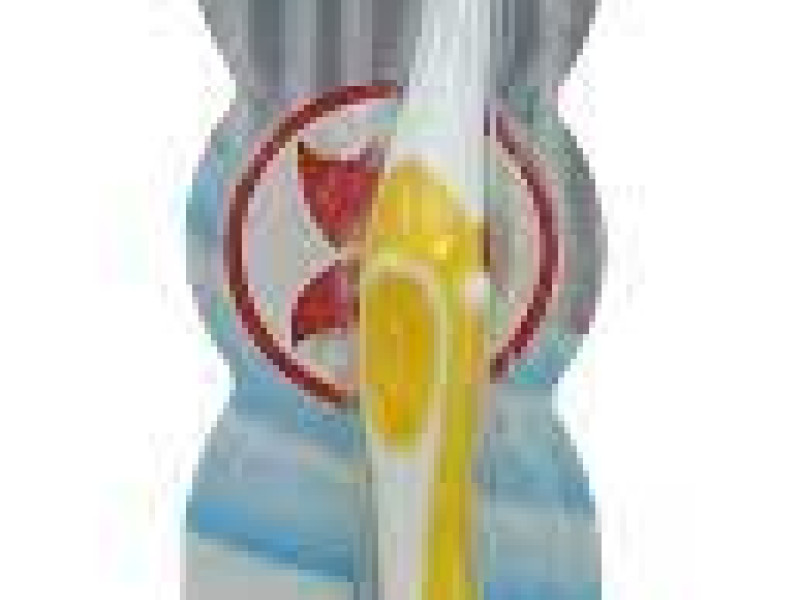 FUCHS BRUSH SUPER STAR (S) FUCHS BRUSH SUPER STAR (S)